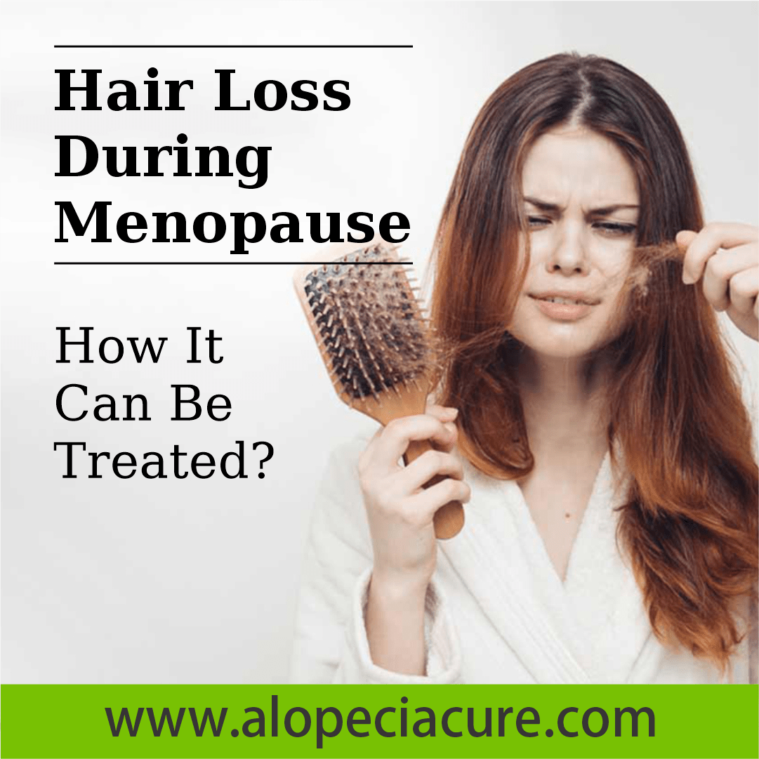 Hair Loss During Menopause